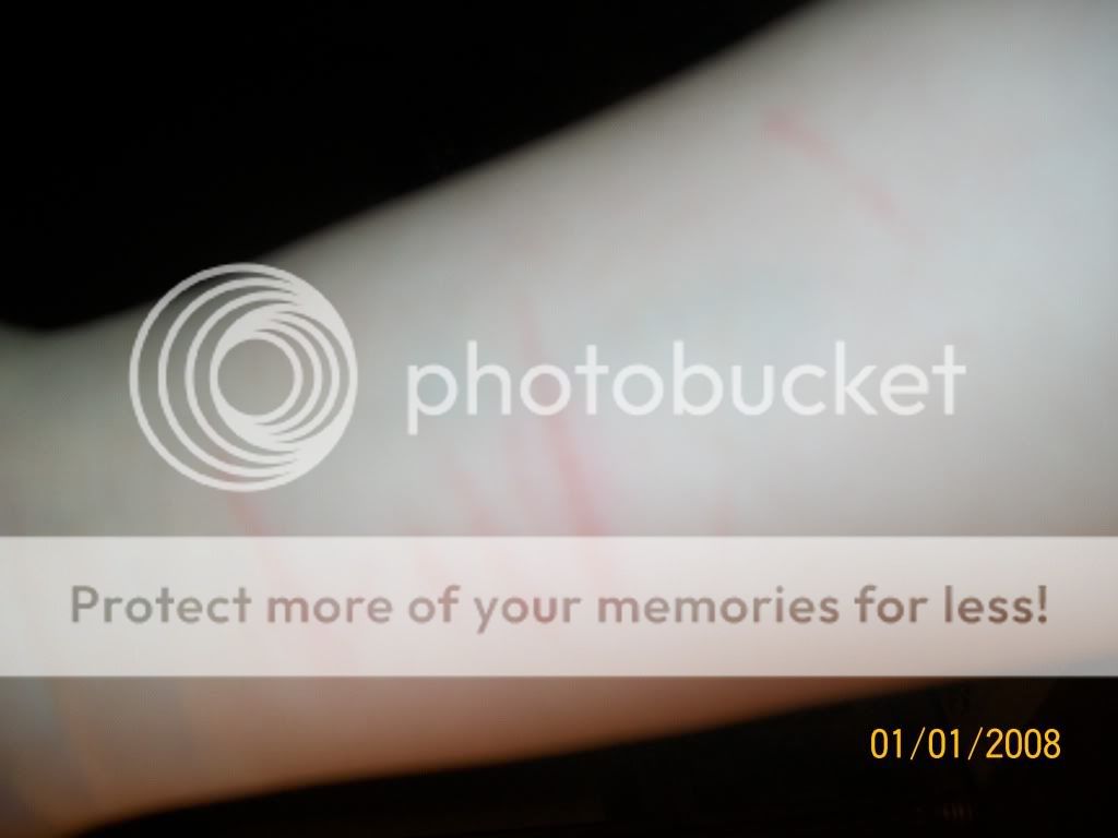 Cuts Left Arm Photo by katieladie333 Photobucket